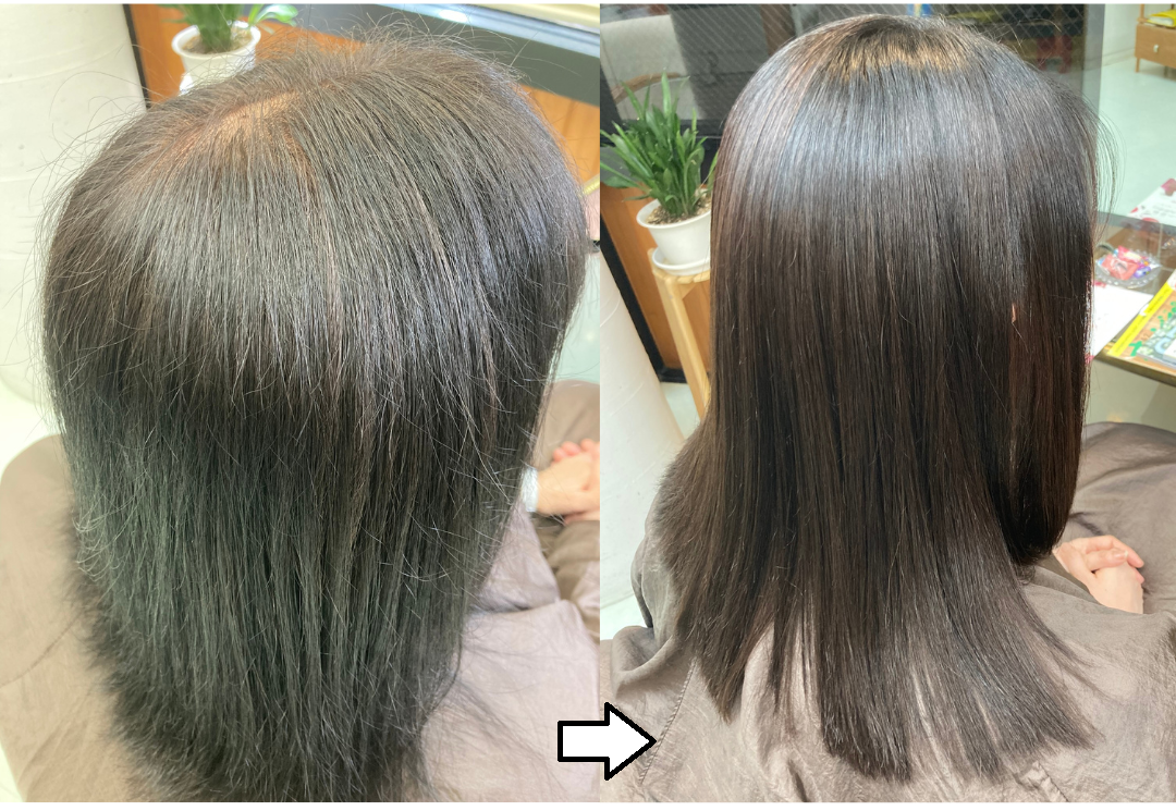 ノンジアミン・過酸化水素水不使用の白髪染め「輝髪ザクロペインター」施術事例