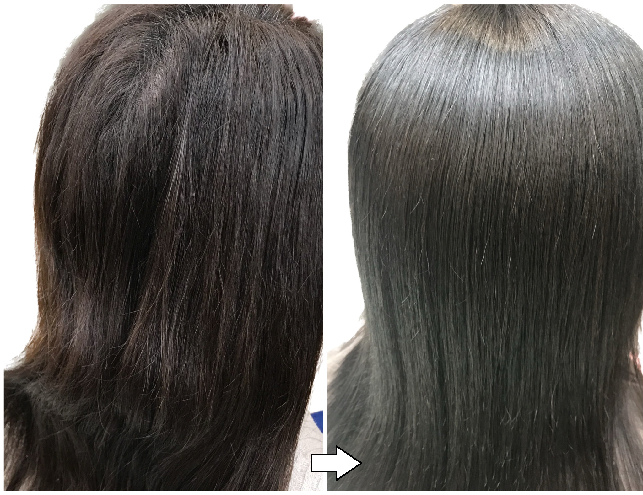 ノンジアミン・過酸化水素水不使用の白髪染め「輝髪ザクロペインター」施術事例