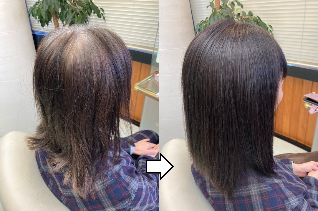 ノンジアミン・過酸化水素水不使用の白髪染め「輝髪ザクロペインター」施術事例